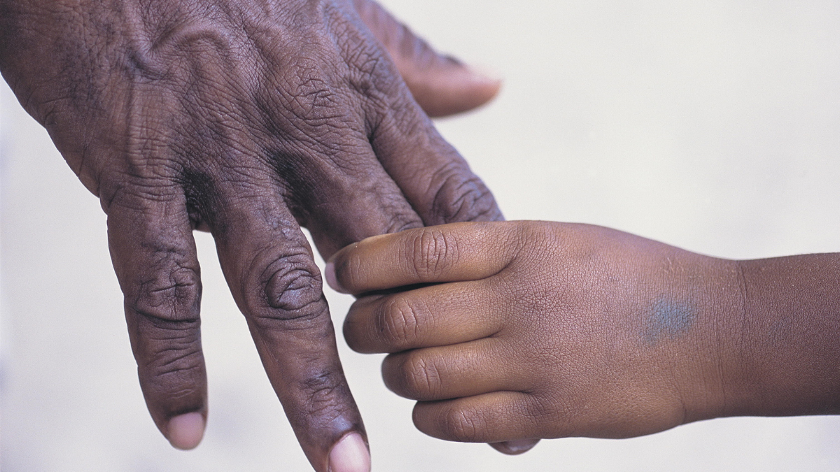 AH&MRC Winter Immunisation Grant